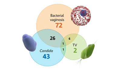 Distribution of vaginal infections. See Table 2 of Cosentino et al.1