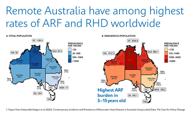 Maps of Australia represent the overall prevalence of RHD 