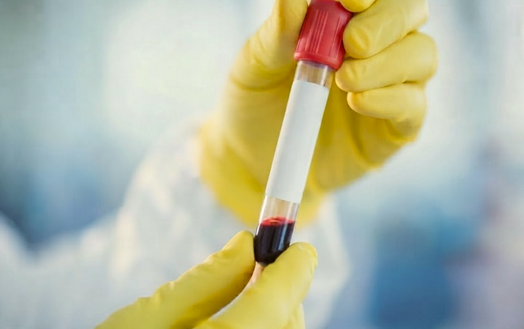 sample preparation 